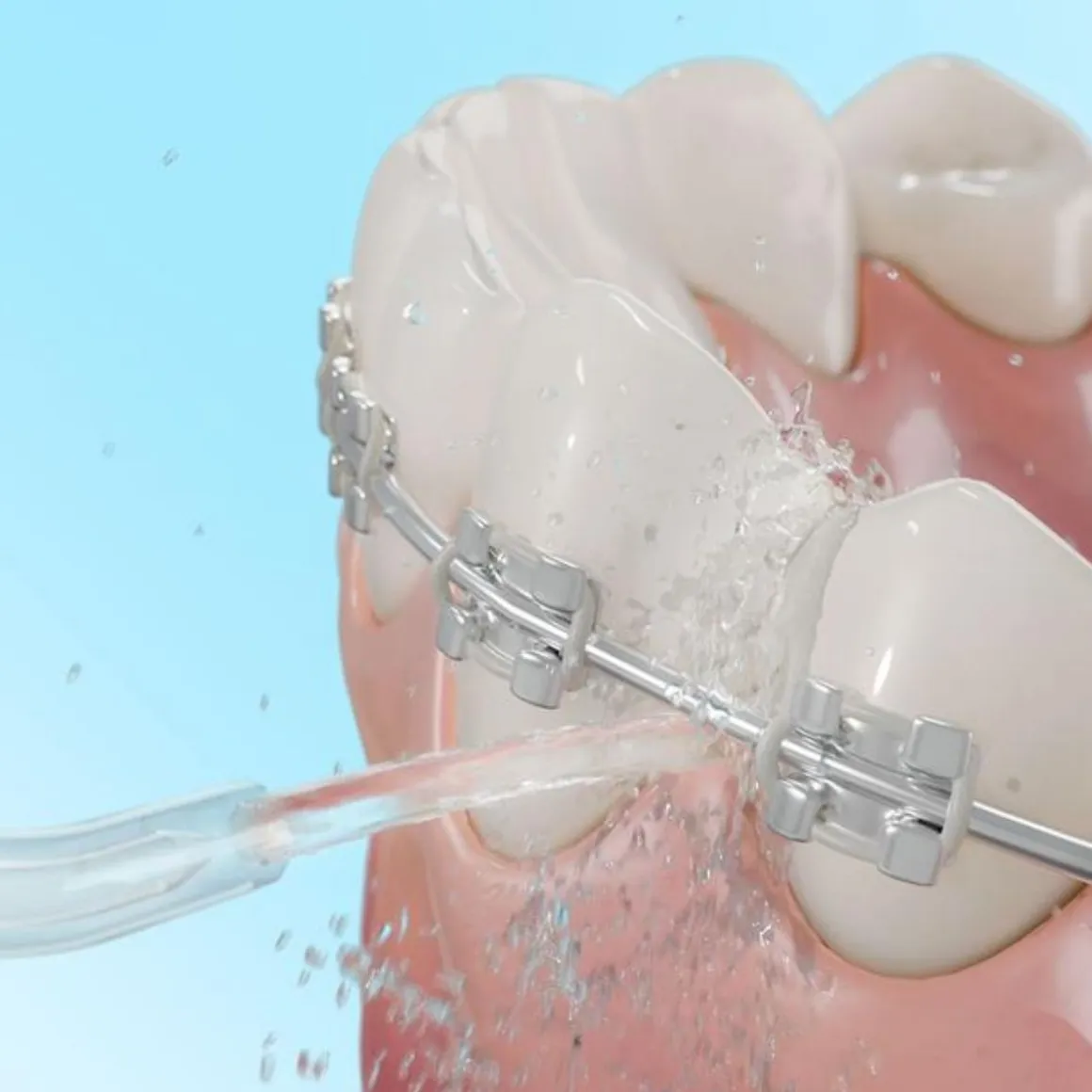 Irrigador bucal Cecotec ToothCare 1100 Jet Liberty 6 posiciones con boquillas negro